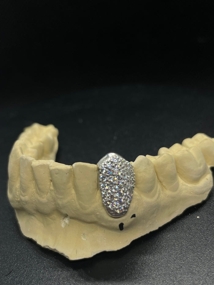 Single VVS Tooth Cap