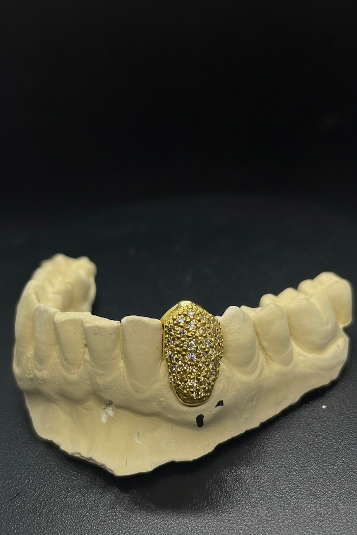 Single VVS Tooth Cap