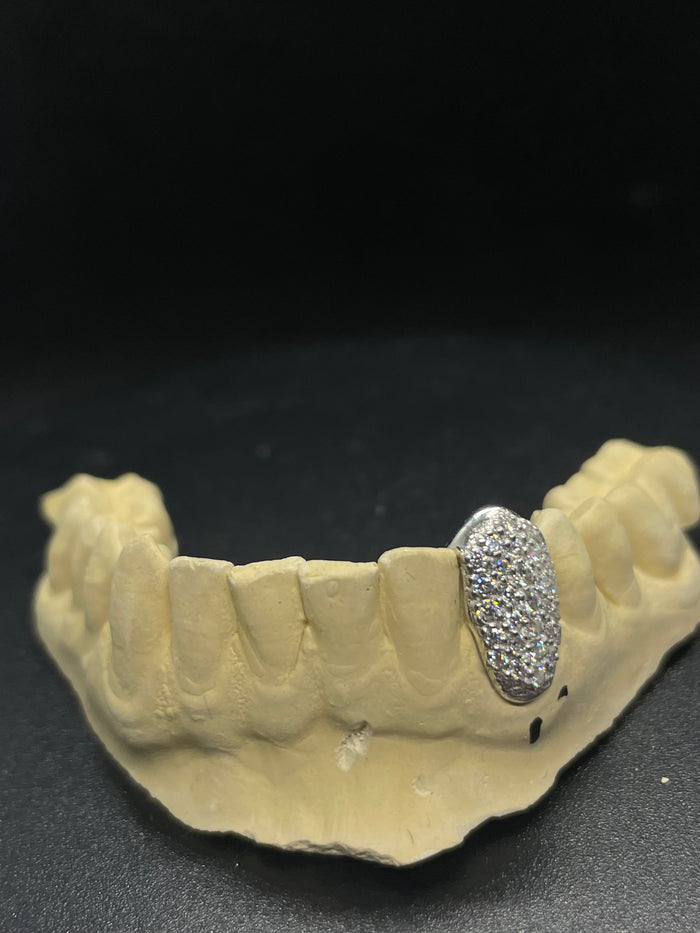 Single VVS Tooth Cap